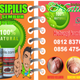 Illustration for article titled obat raja singa murah